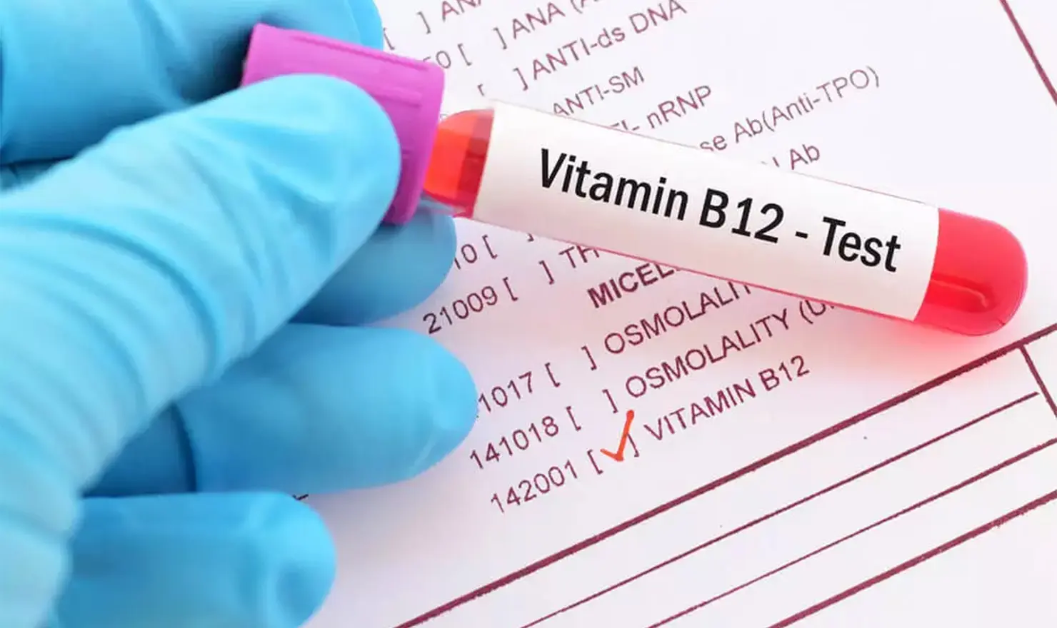 B12 Vitamini Testi