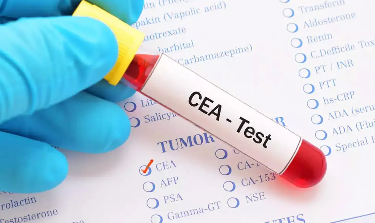 CEA Testi