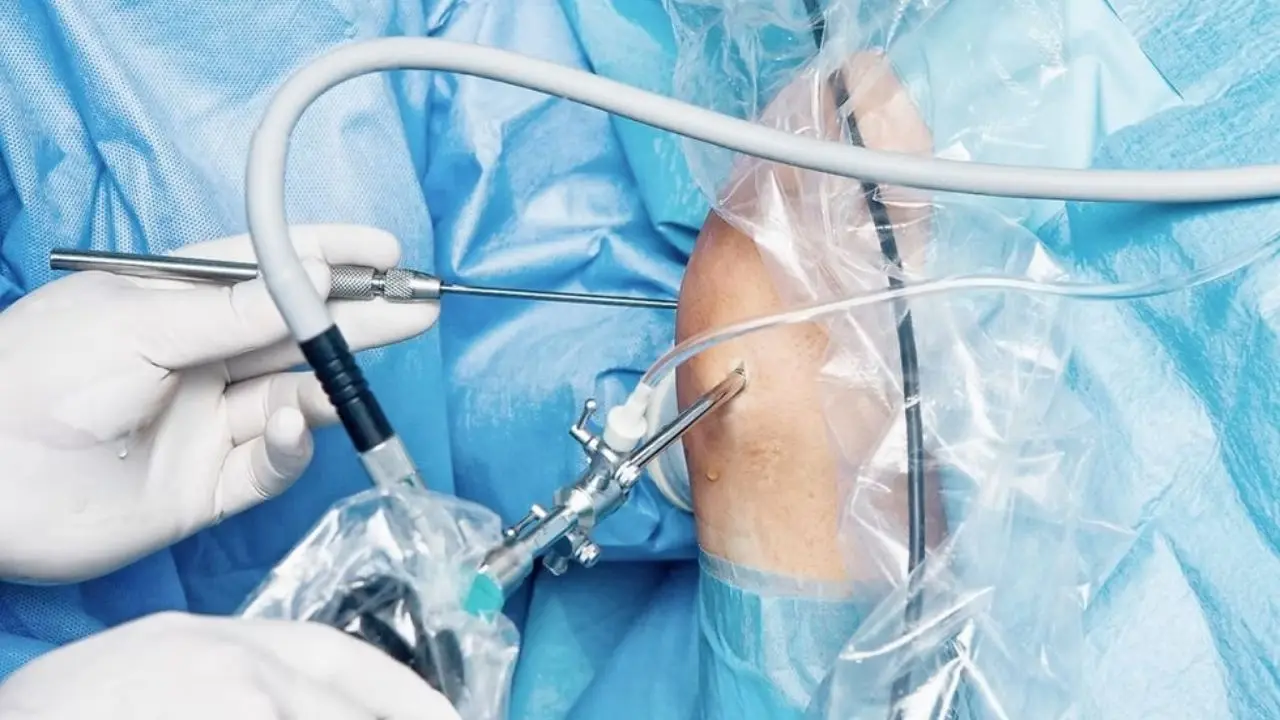 Ayak Bileği Artroskopisi